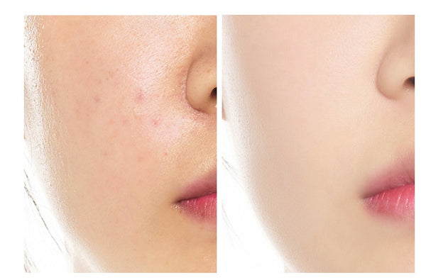 Base Dorada Corrector Natural